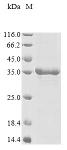 Greater than 85% as determined by SDS-PAGE.