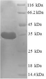 Greater than 90% as determined by SDS-PAGE.