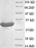 Greater than 90% as determined by SDS-PAGE.