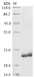 Greater than 85% as determined by SDS-PAGE.