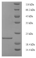 Greater than 90% as determined by SDS-PAGE.