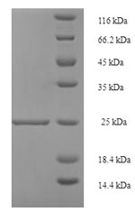 Greater than 90% as determined by SDS-PAGE.