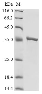 Greater than 90% as determined by SDS-PAGE.