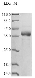 Greater than 85% as determined by SDS-PAGE.