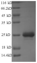 Greater than 90% as determined by SDS-PAGE.