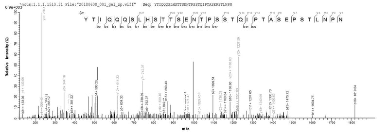 Based on the SEQUEST from database of E.coli host and target protein, the LC-MS/MS Analysis result of this product could indicate that this peptide derived from E.coli-expressed Human respiratory syncytial virus B (strain 18537) G.