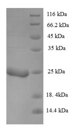 Greater than 90% as determined by SDS-PAGE.