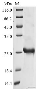 Greater than 85% as determined by SDS-PAGE.