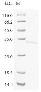 Greater than 85% as determined by SDS-PAGE.