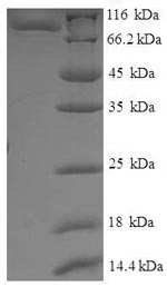 Greater than 90% as determined by SDS-PAGE.