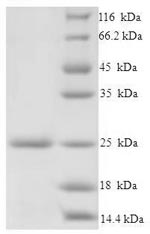 Greater than 90% as determined by SDS-PAGE.