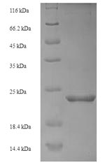 Greater than 90% as determined by SDS-PAGE.