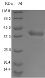 Greater than 90% as determined by SDS-PAGE.