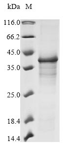 Greater than 85% as determined by SDS-PAGE.