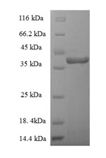 Greater than 90% as determined by SDS-PAGE.