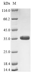 Greater than 85% as determined by SDS-PAGE.