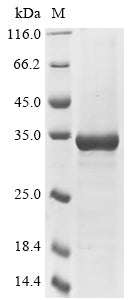 Greater than 85% as determined by SDS-PAGE.