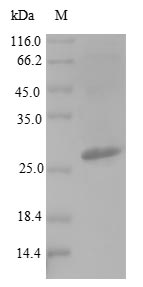 Greater than 90% as determined by SDS-PAGE.