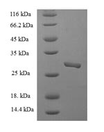 Greater than 90% as determined by SDS-PAGE.