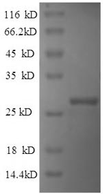 Greater than 90% as determined by SDS-PAGE.