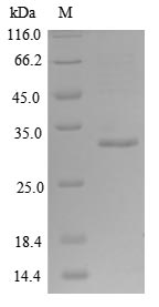 Greater than 85% as determined by SDS-PAGE.