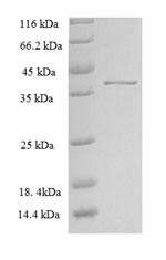 Greater than 90% as determined by SDS-PAGE.