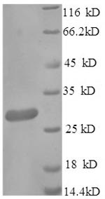 Greater than 90% as determined by SDS-PAGE.