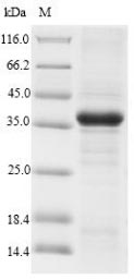 Greater than 90% as determined by SDS-PAGE.