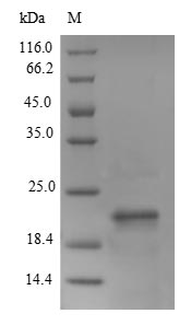 Greater than 90% as determined by SDS-PAGE.