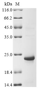 Greater than 85% as determined by SDS-PAGE.