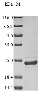 Greater than 85% as determined by SDS-PAGE.