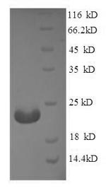 Greater than 90% as determined by SDS-PAGE.