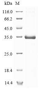 Greater than 85% as determined by SDS-PAGE.