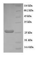 Greater than 90% as determined by SDS-PAGE.