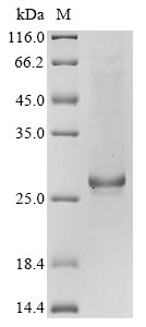 Greater than 85% as determined by SDS-PAGE.