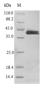 Greater than 90% as determined by SDS-PAGE.