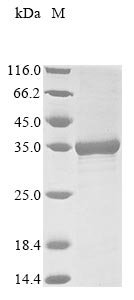 Greater than 85% as determined by SDS-PAGE.