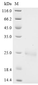 Greater than 90% as determined by SDS-PAGE.