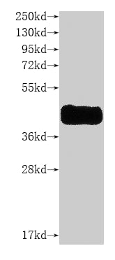 this product is detected by Anti-CCR8 recombinant Antibody