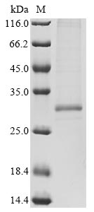 Greater than 85% as determined by SDS-PAGE.