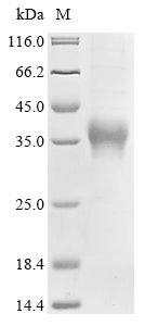 Greater than 85% as determined by SDS-PAGE.