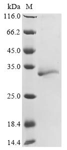 Greater than 85% as determined by SDS-PAGE.