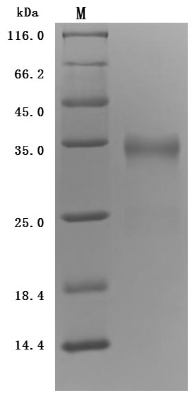 Greater than 95% as determined by SDS-PAGE.