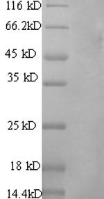 Greater than 90% as determined by SDS-PAGE.