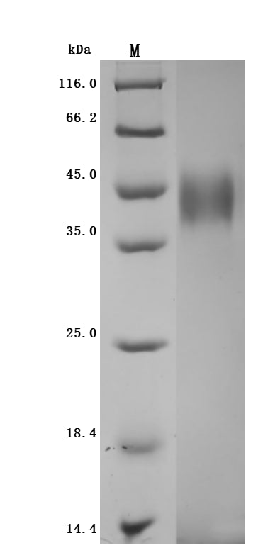 Greater than 95% as determined by SDS-PAGE.