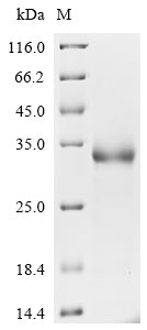 Greater than 90% as determined by SDS-PAGE.