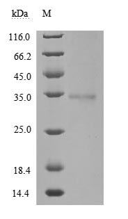 Greater than 85% as determined by SDS-PAGE.