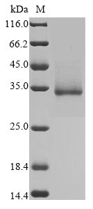 Recombinant Sars-Cov-2 Spike Glycoprotein (S) Protein (His)