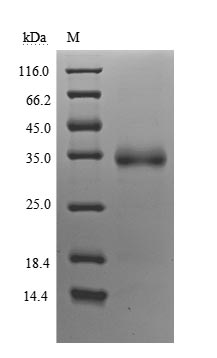 Greater than 90% as determined by SDS-PAGE.