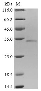 Greater than 85% as determined by SDS-PAGE.